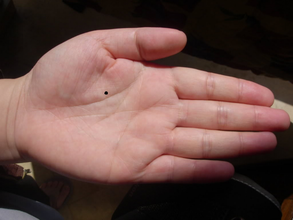 11 vị trí nốt ruồi ở tay nói lên điều gì? – 