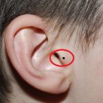 Đàn ông có nốt ruồi ở tai có ý nghĩa gì?