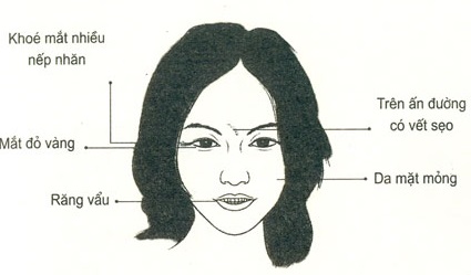 Tướng mặt phụ nữ dễ bị kích động (ảnh minh họa).